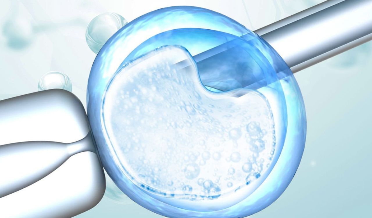 Advanced Laser Assisted Hatching Treatment in Bareilly